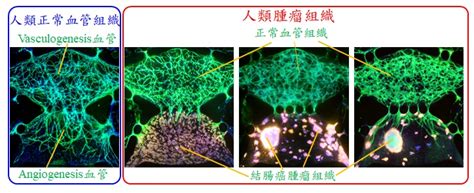 新生兒血管斑|腫瘤血管新生測試之三維細胞球共培養微流體晶片技術